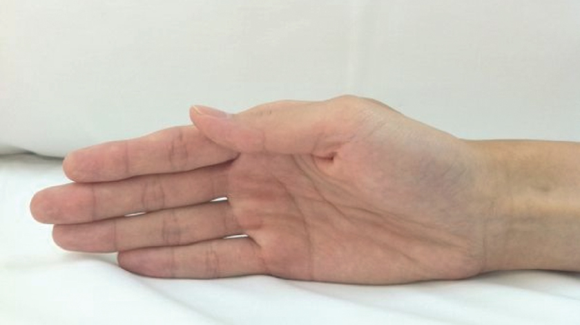 de-quervains-tenosynovitis-causes-symptoms-and-prevention