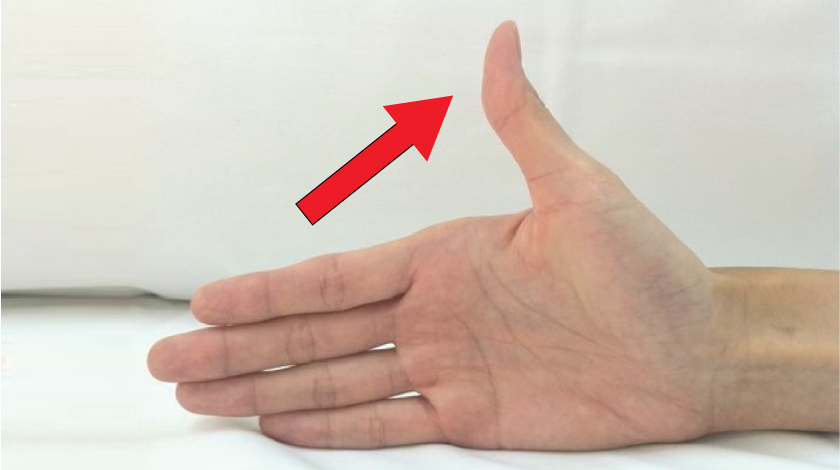 de-quervains-tenosynovitis-causes-symptoms-and-prevention