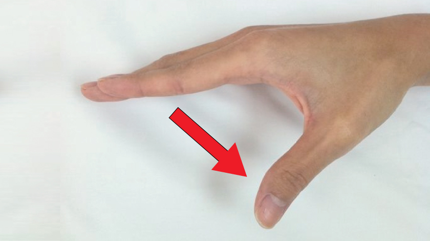 de-quervains-tenosynovitis-causes-symptoms-and-prevention