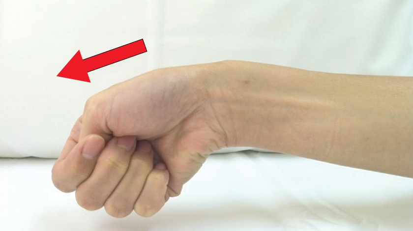 de-quervains-tenosynovitis-causes-symptoms-and-prevention
