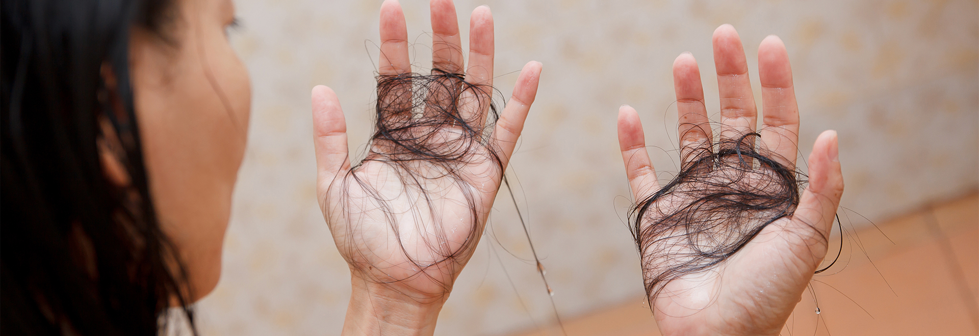 hair-loss-food