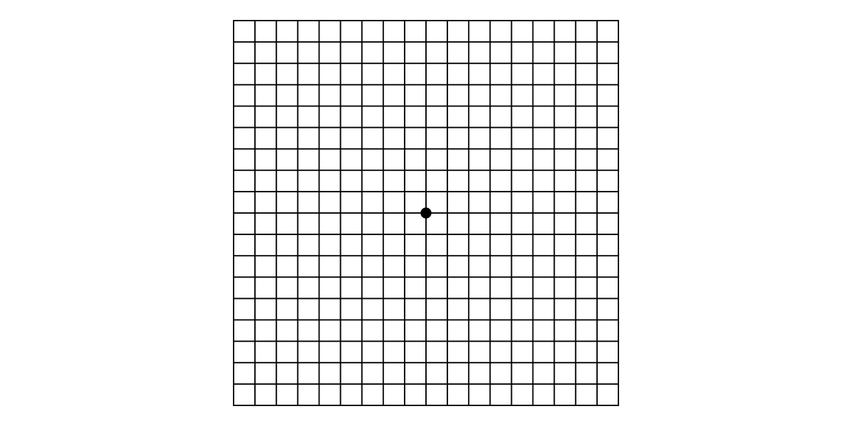 Macular Degeneration Causes Symptoms Treatment Self Diagnosis