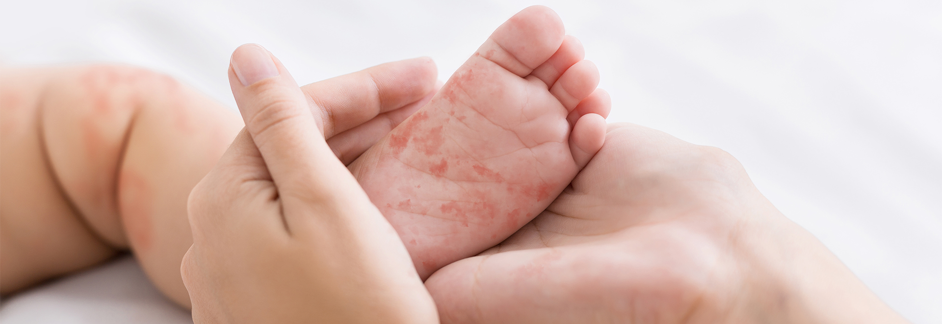 what-is-enterovirus-transmission-diseases
