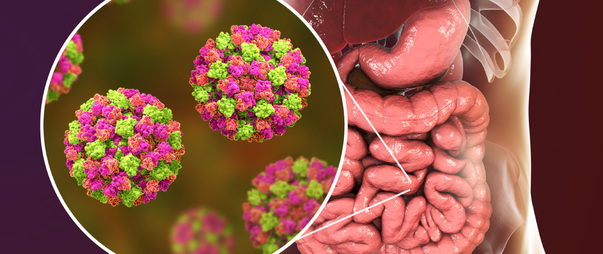 Understanding-Norovirus-Transmission-Routes